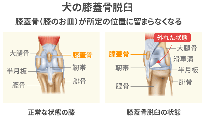 通常の膝とパテラ(膝蓋骨脱臼)の膝のイメージ図